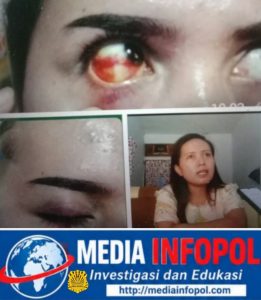 Pengeroyokan Oknum Istri Kades Sukosari, Jatiroto…